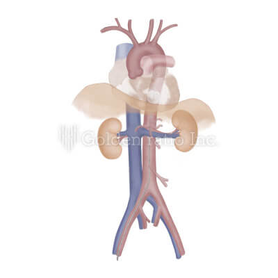 ゴールデンレイシオ 制作実績 岡山赤十字病院様 メディカルイラスト